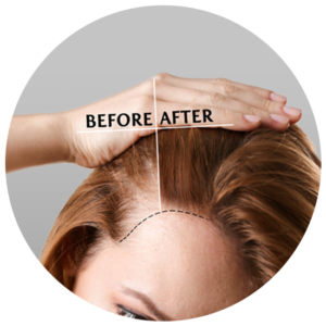 Before-and-After-Image